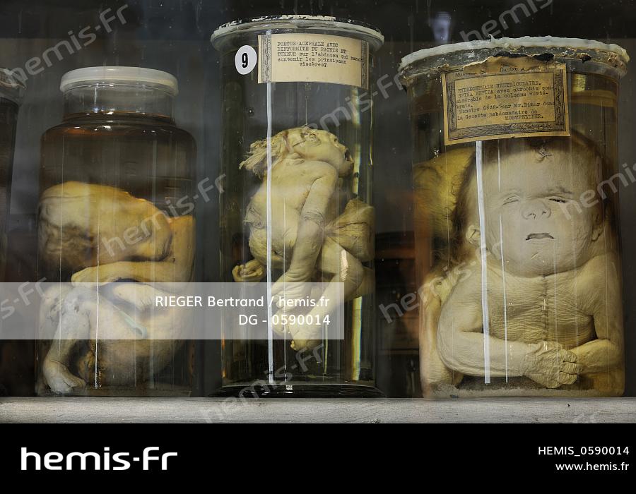 Hemis France Herault Montpellier Centre Historique Faculte Medecine Musee Anatomie Foetus Collection Teratologie Hemis France Herault Montpellier Centre Historique Faculte Medecine Musee Anatomie Foetus Collection Teratologie